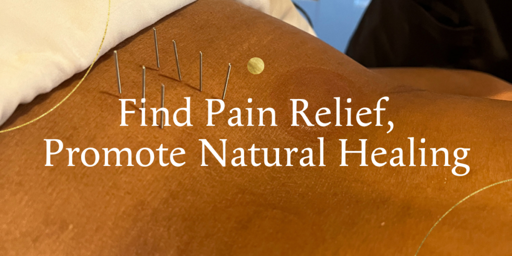 acupuncture needles