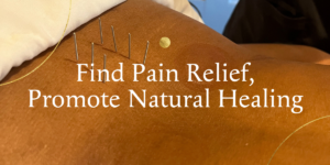 acupuncture needles